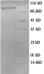 SDS-PAGE