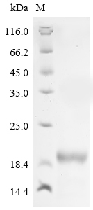 SDS-PAGE