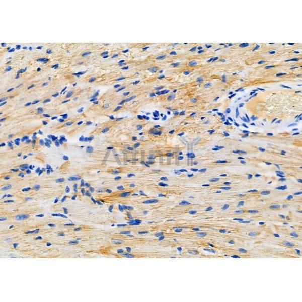 Валидация Affinity DF9605 - 22311