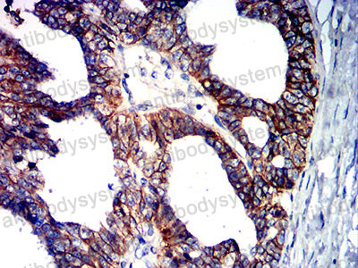 Валидация AntibodySystem RHE14008 (1986)