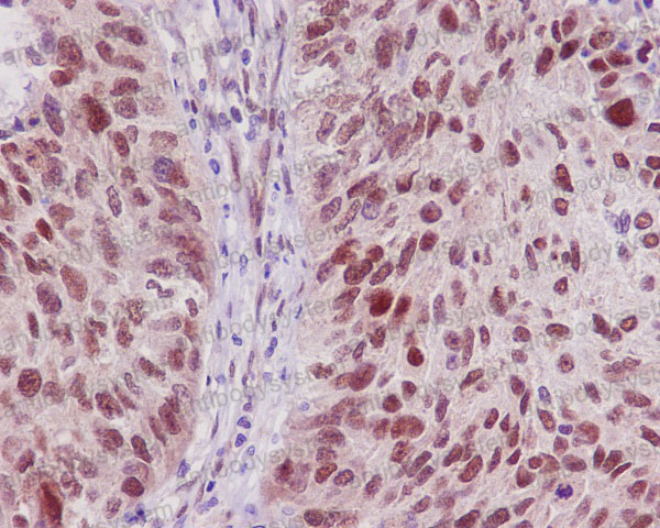 Валидация AntibodySystem RHJ88301