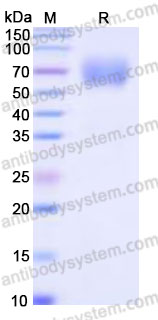 EHG70401, SDS-PAGE