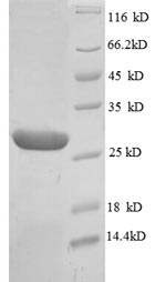 SDS-PAGE