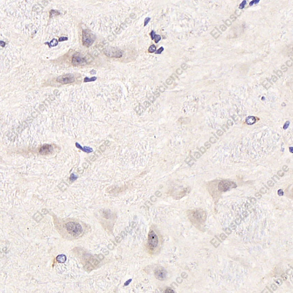 Иммуногистохимия, CDC25A, ткань мозга крысы