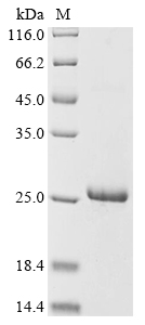 SDS-PAGE