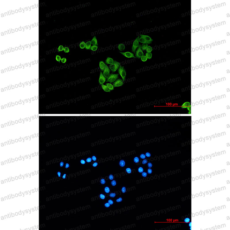 Валидация IF - AntibodySystem RHJ57302