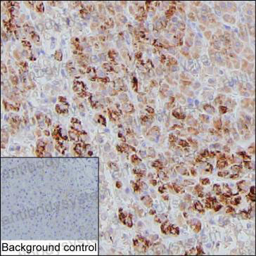 Валидация AntibodySystem RHN42901
