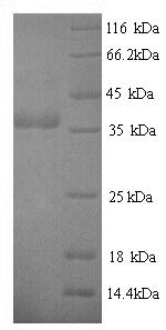 SDS-PAGE