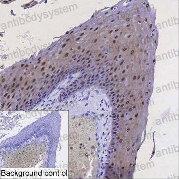 Валидация AntibodySystem RHD67402