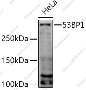 Вестерн-блоттинг, 53BP1, клетки HeLa