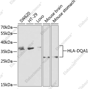 Вестерн-блоттинг, HLA-DQA1, различные клеточные линии