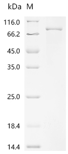 SDS-PAGE