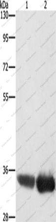 Вестерн-блоттинг, AIMP1, клетки HeLa и HepG2