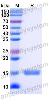 Валидация SDS-PAGE - AntibodySystem RHD77301