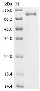 SDS-PAGE