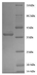 SDS-PAGE