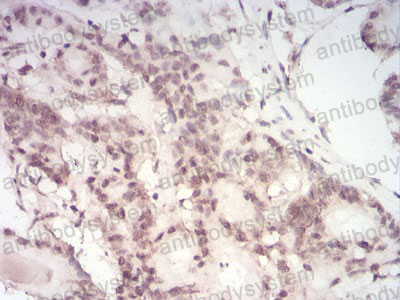 Валидация AntibodySystem RHA28702 (83)