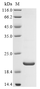 SDS-PAGE