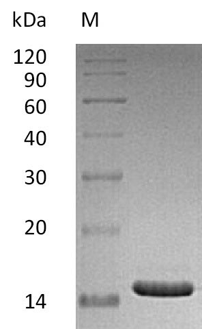 SDS-PAGE