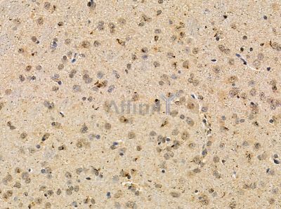 Валидация Affinity DF13870 - 9594