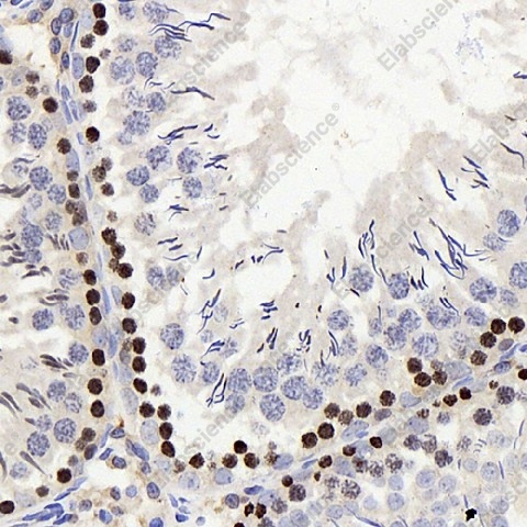 Иммуногистохимия, Histone H2A.X, ткань семенника крысы