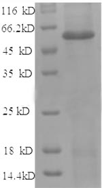 SDS-PAGE