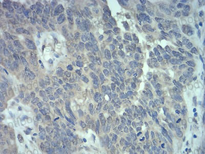 Валидация AntibodySystem RHD39304