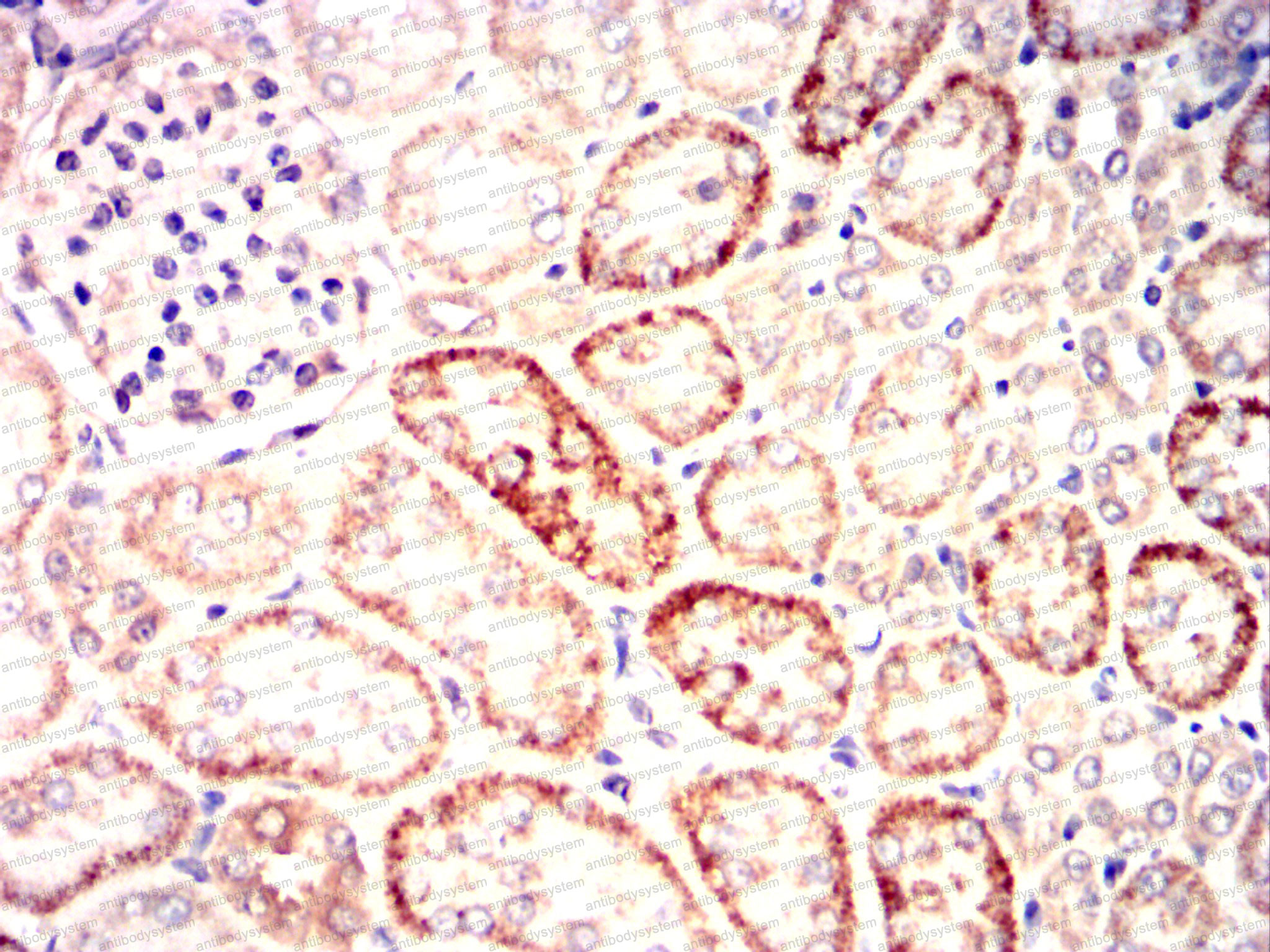 Валидация AntibodySystem RHD53604