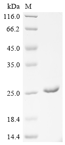 SDS-PAGE