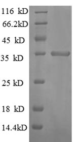 SDS-PAGE