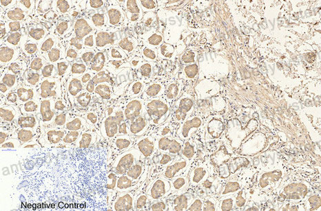 Валидация AntibodySystem RHB95907 (484)