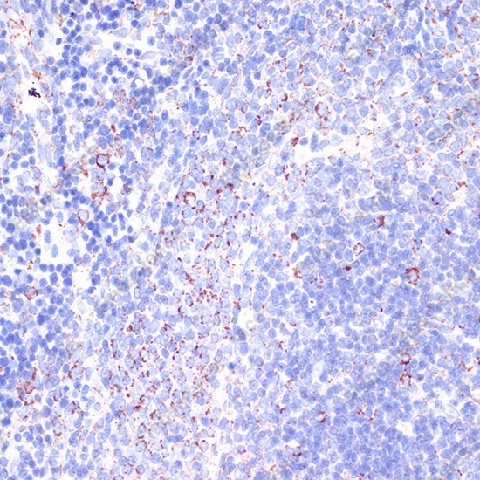 Иммуногистохимия, CD18, ткань селезенки крысы