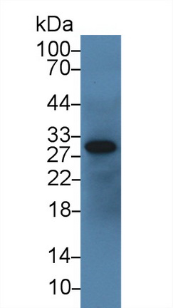 14221