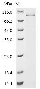 SDS-PAGE