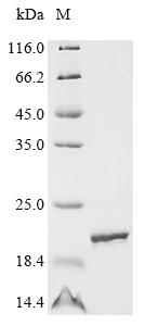 SDS-PAGE