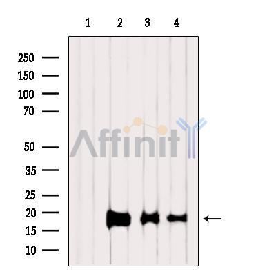 Валидация Affinity DF6175 - 17421