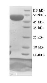 SDS-PAGE