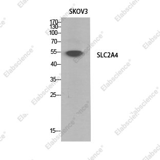 Вестерн-блоттинг, GLUT-4, клетки SKOV3