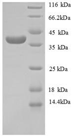 SDS-PAGE