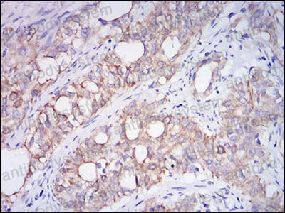 Валидация AntibodySystem RHC33004