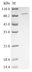 SDS-PAGE