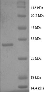 SDS-PAGE