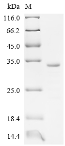 SDS-PAGE