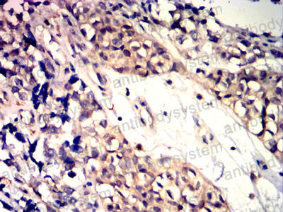 Валидация AntibodySystem RHD06601 (1303)