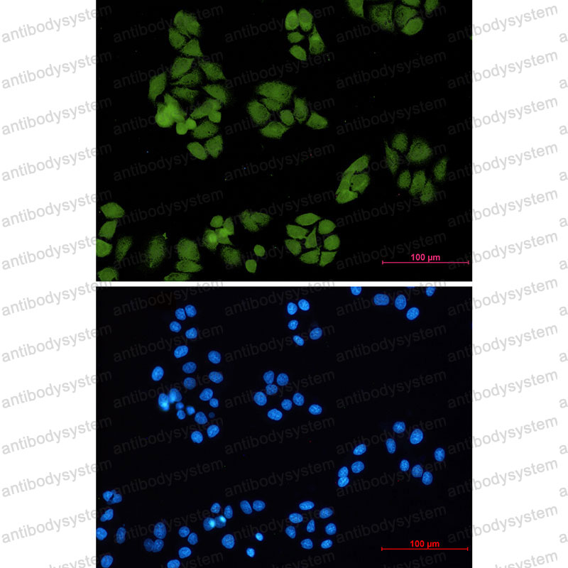 Валидация IF - AntibodySystem RHG55201
