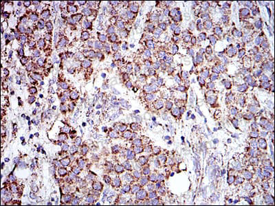 Валидация AntibodySystem RHE08102 (1960)