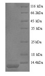 SDS-PAGE