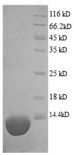 SDS-PAGE