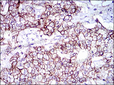 Валидация AntibodySystem RHG64005 (3036)