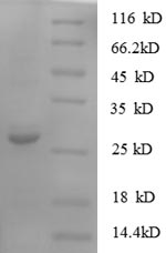 SDS-PAGE